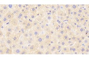 Detection of GSTp in Mouse Liver Tissue using Polyclonal Antibody to Glutathione S Transferase Pi (GSTp) (GSTP1 抗体  (AA 1-210))