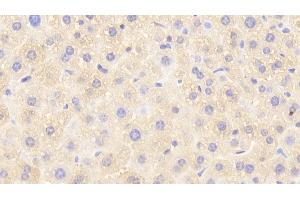 Detection of GSTp in Mouse Liver Tissue using Polyclonal Antibody to Glutathione S Transferase Pi (GSTp) (GSTP1 抗体  (AA 1-210))