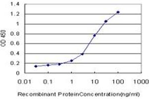 Detection limit for recombinant GST tagged LMTK2 is approximately 0. (LMTK2 抗体  (AA 1181-1280))