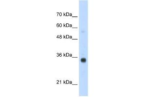 WB Suggested Anti-HOXB4 Antibody Titration:  1. (HOXB4 抗体  (N-Term))