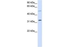 Image no. 1 for anti-Short Stature Homeobox 2 (SHOX2) (AA 108-157) antibody (ABIN6744236) (SHOX2 抗体  (AA 108-157))