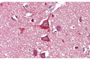 Detection of HEXb in Human Cerebrum Tissue using Polyclonal Antibody to Hexosaminidase B Beta (HEXb) (HEXB 抗体  (AA 122-311))