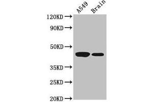Western Blot Positive WB detected in: A549 whole cell lysate, Mouse brain tissue All lanes: AMT antibody at 3. (Aminomethyltransferase 抗体  (AA 180-260))