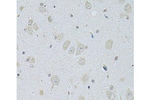 Immunohistochemistry of paraffin-embedded Rat brain using SLC29A1 Polyclonal Antibody at dilution of 1:100 (40x lens). (SLC29A1 抗体)