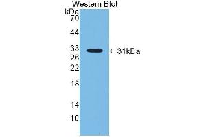 Western Blotting (WB) image for anti-Lipopolysaccharide Binding Protein (LBP) (AA 224-468) antibody (ABIN1859618) (LBP 抗体  (AA 224-468))