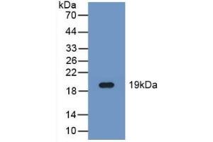 Detection of Recombinant FADS2, Human using Polyclonal Antibody to Fatty Acid Desaturase 2 (FADS2) (FADS2 抗体  (AA 1-130))