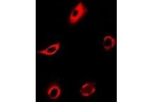 Immunofluorescent analysis of PPX staining in MCF7 cells. (PPP4C 抗体)