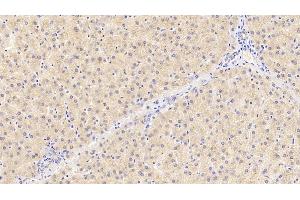 Detection of PROC in Human Liver Tissue using Polyclonal Antibody to Protein C (PROC) (PROC 抗体)