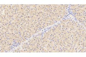 Detection of PROC in Human Liver Tissue using Polyclonal Antibody to Protein C (PROC) (PROC 抗体)