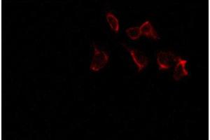 Immunofluorescence (fixed cells) (IF/ICC) image for anti-Estrogen Receptor 1 (ESR1) (pSer106) antibody (ABIN6256096)
