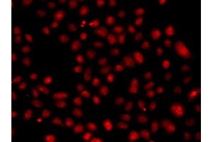 Immunofluorescence analysis of A549 cell using FBXW11 antibody. (FBXW11 抗体)