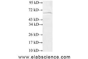 Western Blot analysis of 293T cells using TRIP4 Polyclonal Antibody at dilution of 1:600 (TRIP4 抗体)