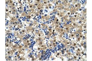 Ctp Synthase antibody was used for immunohistochemistry at a concentration of 4-8 ug/ml to stain Hepatocytes (arrows) in Human Liver. (CTP Synthase 抗体  (N-Term))
