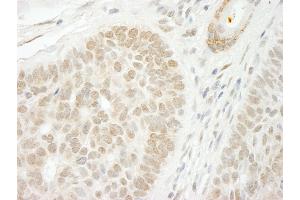 Immunohistochemistry (IHC) image for anti-Cleavage Stimulation Factor, 3' Pre-RNA, Subunit 2, 64kDa, tau Variant (CSTF2T) (AA 566-616) antibody (ABIN7448495)