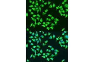 Immunofluorescence analysis of U2OS cells using ATP6 antibody. (MT-ATP6 抗体  (C-Term))