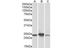 ABIN5539776 (0. (ABHD14B 抗体  (AA 188-200))