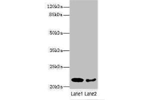 Western blot All lanes: PRDX2 antibody at 9 μg/mL Lane 1: Mouse liver tissue Lane 2: Mouse spleen tissue Secondary Goat polyclonal to rabbit IgG at 1/10000 dilution Predicted band size: 22, 16 kDa Observed band size: 22 kDa (Peroxiredoxin 2 抗体  (AA 2-65))