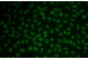 Immunofluorescence analysis of MCF7 cells using KHDRBS3 Polyclonal Antibody (KHDRBS3 抗体)