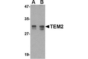 Western blot analysis of TEM2 in rat colon tissue lysate with this product at (A) 1 and (B) 2 μg/ml. (RASD2 抗体  (N-Term))