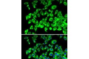 Immunofluorescence analysis of MCF7 cells using RPL13 Polyclonal Antibody (RPL13 抗体)