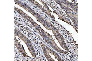 IHC analysis of TIP49A/RUVBL1 using anti-TIP49A/RUVBL1 antibody (ABIN7599928). (RUVBL1 抗体  (AA 13-23))