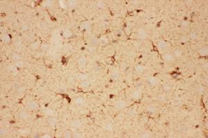 Anti-CNTF Picoband antibody,  IHC(P): Rat Brain Tissue (CNTF 抗体  (AA 2-198))