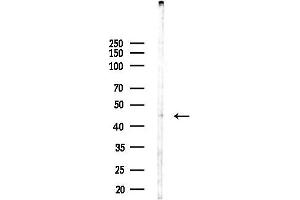 anti-Abhydrolase Domain Containing 8 (ABHD8) (Internal Region) antibody