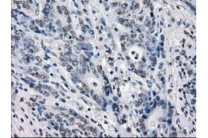 Image no. 1 for anti-Budding Uninhibited By Benzimidazoles 1 Homolog beta (Yeast) (BUB1B) antibody (ABIN1496996) (BUB1B 抗体)