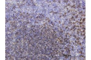 Immunoperoxidase of monoclonal antibody to MS4A1 on formalin-fixed paraffin-embedded human tonsil. (CD20 抗体  (AA 1-297))