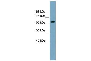 WB Suggested Anti-ELP2 Antibody Titration: 0.