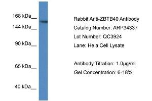 WB Suggested Anti-ZBTB40 Antibody   Titration: 1. (ZBTB40 抗体  (N-Term))