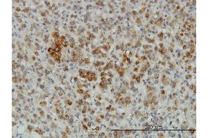 Immunoperoxidase of monoclonal antibody to CREG1 on formalin-fixed paraffin-embedded human adrenal gland. (CREG1 抗体  (AA 121-220))