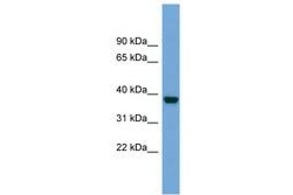ATP1B4 抗体  (AA 215-264)