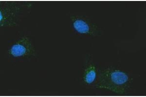 IF analysis of Citrin/SLC25A13 using anti-Citrin/SLC25A13 antibody (ABIN7599512). (slc25a13 抗体  (AA 1-643))