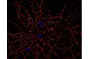 Indirect immunostaining of PFA fixed rat hippocampus neurons (dilution 1 : 500; red). (CACNA1B 抗体  (alpha-1E subunit))