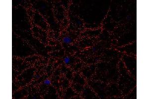 Indirect immunostaining of PFA fixed rat hippocampus neurons (dilution 1 : 500; red). (CACNA1B 抗体  (alpha-1E subunit))