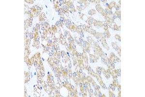 Immunohistochemistry of paraffin-embedded human liver injury using CHD1 antibody (ABIN5975217) at dilution of 1/100 (40x lens). (CHD1 抗体)