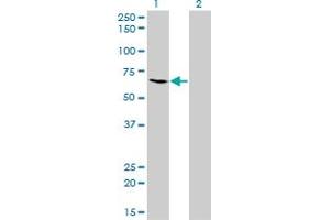 Western Blotting (WB) image for anti-Malic Enzyme 1, NADP(+)-Dependent, Cytosolic (ME1) (AA 1-573) antibody (ABIN598801) (ME1 抗体  (AA 1-573))