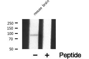 Western blot analysis of extracts from mouse Brian, using MEKKK 1 antibody. (MAP4K1 抗体  (Internal Region))