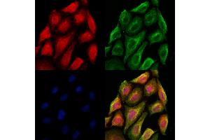 ABIN6264671 and ABIN6273069 staining Hela cells by IF/ICC. (RBM4 抗体  (Internal Region))
