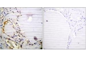 Immunohistochemistry analysis of paraffin-embedded human thyroid gland tissue, using RBBP8 (Ab-664) Antibody. (Retinoblastoma Binding Protein 8 抗体  (AA 630-679))