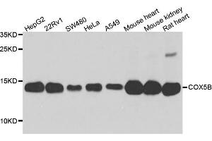 Western blot analysis of extract of various cells, using COX5B antibody. (COX5B 抗体)