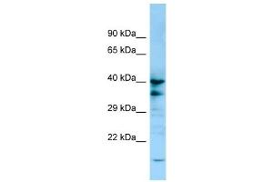 WB Suggested Anti-P2RY13 Antibody Titration: 1. (Purinergic Receptor P2Y, G-Protein Coupled, 13 (P2RY13) (C-Term) 抗体)