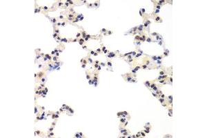 Immunohistochemistry (Paraffin-embedded Sections) (IHC (p)) image for anti-Ring Finger Protein 2 (RNF2) (AA 1-336) antibody (ABIN6147029)