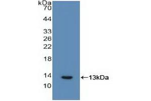 Western blot analysis of recombinant Human IL6R. (IL-6 Receptor 抗体  (AA 216-356))