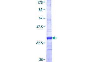 SLC2A9 Protein (AA 224-287) (GST tag)
