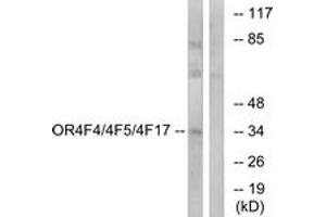 Western blot analysis of extracts from MCF-7 cells, using OR4F4/4F5/4F17 Antibody. (OR4F4/4F5/4F17 抗体  (AA 51-100))