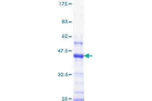 Image no. 1 for Insulin-Like Growth Factor 1 Receptor (IGF1R) (AA 761-870) protein (GST tag) (ABIN1307545)