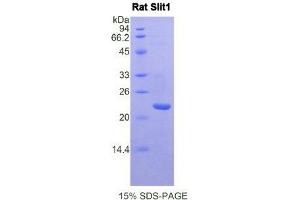 SDS-PAGE (SDS) image for Slit Homolog 1 (SLIT1) (AA 611-791) protein (His tag) (ABIN1877755) (SLIT1 Protein (AA 611-791) (His tag))
