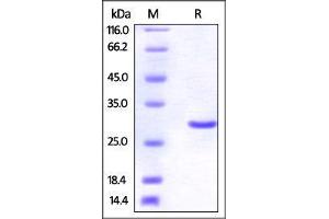 Human UCH-L3, His Tag on SDS-PAGE under reducing (R) condition. (UCHL3 Protein (AA 2-230) (His tag))